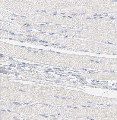 Immunohistochemistry-Paraffin: ELF3/ESE-1 Antibody [NBP1-87945] - Staining of human skeletal muscle shows no positivity in myocytes as expected.