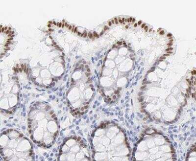 Immunohistochemistry-Paraffin: ELF3/ESE-1 Antibody [NBP1-87945] - Staining of human colon shows moderate nuclear positivity in glandular cells.