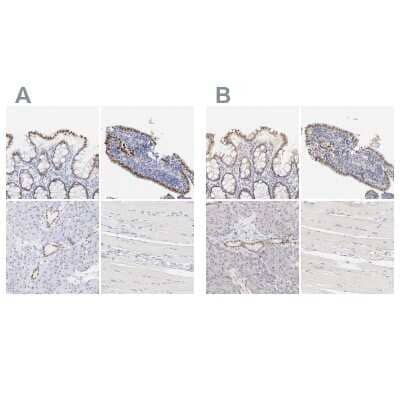 <b>Independent Antibodies Validation and Orthogonal Strategies Validation.</b>Immunohistochemistry-Paraffin: ELF3/ESE-1 Antibody [NBP1-87945] - Staining of human colon, endometrium, pancreas and skeletal muscle using Anti-ELF3/ESE-1 antibody NBP1-87945 (A) shows similar protein distribution across tissues to independent antibody NBP1-87946 (B).