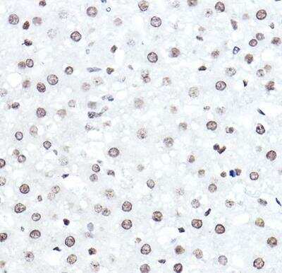 Immunohistochemistry-Paraffin: ELF5 Antibody [NBP3-04468] - Rat liver using ELF5 Rabbit pAb at dilution of 1:50 (40x lens).