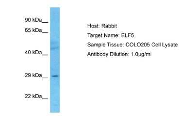 Western Blot: ELF5 Antibody [NBP2-87351] - Host: Rabbit. Target Name: ELF5. Sample Type: COLO205 Whole Cell lysates. Antibody Dilution: 1.0ug/ml