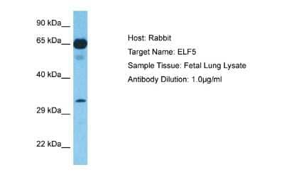 Western Blot: ELF5 Antibody [NBP2-87352] - Host: Rabbit. Target Name: ELF5. Sample Type: Fetal Lung lysates. Antibody Dilution: 1.0ug/ml