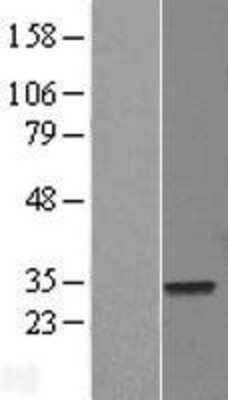 Western Blot ELF5 Overexpression Lysate