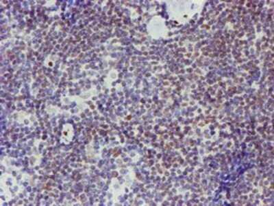 Immunohistochemistry: ELK3 Antibody (OTI1H3) - Azide and BSA Free [NBP2-70643] - Staining of paraffin-embedded Human lymphoma tissue using anti-ELK3 mouse monoclonal antibody.