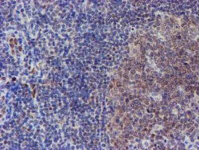 Immunohistochemistry: ELK3 Antibody (OTI1H3) - Azide and BSA Free [NBP2-70643] - Staining of paraffin-embedded Human tonsil using anti-ELK3 mouse monoclonal antibody.