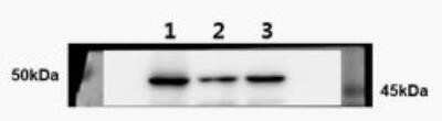 Western Blot: ELK3 Antibody (OTI1H3) - Azide and BSA Free [NBP2-70643] - Breast cancer cells. Lane 1: MDA-MB231 + Negative control siRNA. Lane 2: MDA-MB231 + siELK3-1. Lane 3: MDA-MB231 + siELK3-2. Image from verified customer review.