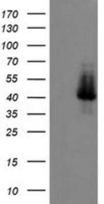 Western Blot: ELK3 Antibody (OTI1H3) - Azide and BSA Free [NBP2-70643] - HEK293T cells were transfected with the pCMV6-ENTRY control (Left lane) or pCMV6-ENTRY ELK3 (Right lane) cDNA for 48 hrs and lysed. Equivalent amounts of cell lysates (5 ug per lane) were separated by SDS-PAGE and immunoblotted with anti-ELK3.