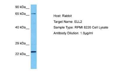 Western Blot: ELL2 Antibody [NBP2-84847] - Host: Rabbit. Target Name: ELL2. Sample Tissue: Human RPMI 8226 Whole Cell lysates. Antibody Dilution: 1ug/ml