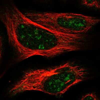 Immunocytochemistry/Immunofluorescence: ELL3 Antibody [NBP1-82116] - Immunofluorescent staining of human cell line U-2 OS shows localization to nucleoli.