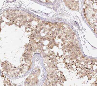 Immunohistochemistry-Paraffin ELL3 Antibody