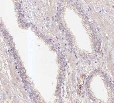 Immunohistochemistry-Paraffin ELL3 Antibody