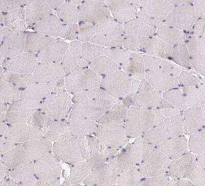 Immunohistochemistry-Paraffin: ELL3 Antibody [NBP1-82116] - Staining of human skeletal muscle shows no positivity in myocytes as expected.