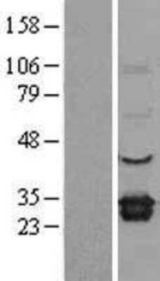 Western Blot: ELMO1 Overexpression Lysate (Adult Normal) [NBL1-10239] Left-Empty vector transfected control cell lysate (HEK293 cell lysate); Right -Over-expression Lysate for ELMO1.