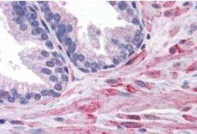 Immunohistochemistry-Paraffin ELMO2 Antibody