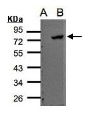 Western Blot: ELMO2 Antibody [NBP2-16318] - Western Blot analysis of ELMO2 expression in transfected 293T cell line by ELMO2 polyclonal antibody. A: Non-transfected lysate. B: ELMO2 transfected lysate. 12% SDS PAGE gel, diluted at 1:500.