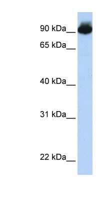 Western Blot: ELMO3 Antibody [NBP1-59089] - 721_B cell lysate, concentration 0.2-1 ug/ml.