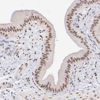 Immunohistochemistry-Paraffin: ELMSAN1 Antibody [NBP1-88407] - Staining of human gallbladder shows moderate nuclear positivity in glandular cells.