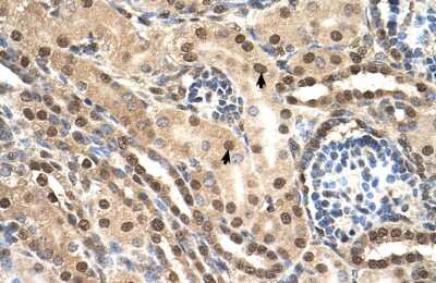 Immunohistochemistry: ELOB/ELOC/VHL Complex Antibody [NBP2-82356] - Human kidney