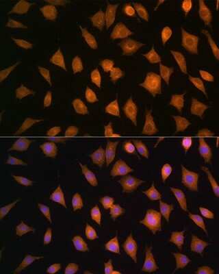 Immunocytochemistry/ Immunofluorescence ELOVL4 Antibody - Azide and BSA Free