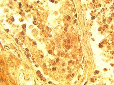 Immunohistochemistry: ELOVL4 Antibody [NBP3-11920] - Immunohistochemical staining of normal human testis tissue using ELOV4 antibody at 15 ug/ml.