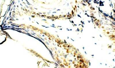 Immunohistochemistry-Paraffin: ELOVL4 Antibody [NBP3-12303] - Human skin. 1:100 dilution in IHC blockign buffer. DAB (brown) staining and Hematoxylin QS (blue) counterstain. 40X magnfication.