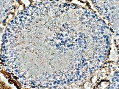 Immunohistochemistry-Paraffin: ELOVL4 Antibody [NBP3-12304] - Rat testis. 1:50 dilution in IHC blocking buffer. DAB (brown) staining and Hematoxylin QS (blue) counterstain. 40X magnification.