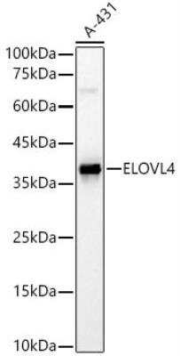 Western Blot ELOVL4 Antibody - Azide and BSA Free