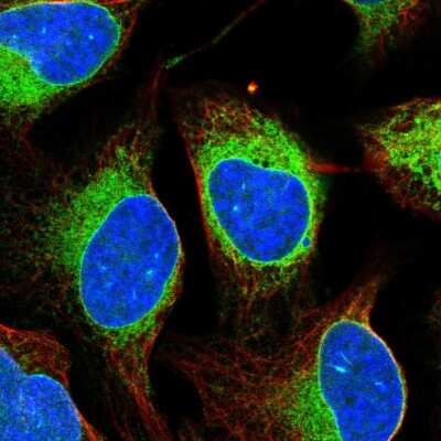 Immunocytochemistry/ Immunofluorescence ELOVL5 Antibody