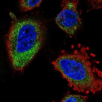 Immunocytochemistry/Immunofluorescence: ELOVL5 Antibody [NBP2-58784] - Staining of human cell line U-251 MG shows localization to endoplasmic reticulum.