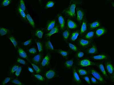 Immunocytochemistry/Immunofluorescence: ELOVL5 Antibody [NBP2-97520] - Immunofluorescence staining of ELOVL5 in U2OS cells. Cells were fixed with 4% PFA, permeabilzed with 0.1% Triton X-100 in PBS, blocked with 10% serum, and incubated with rabbit anti-Human ELOVL5 polyclonal antibody (dilution ratio 1:200) at 4C overnight. Then cells were stained with the Alexa Fluor(R)488-conjugated Goat Anti-rabbit IgG secondary antibody (green) and counterstained with DAPI (blue).Positive staining was localized to Cytoplasm.