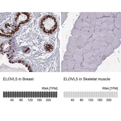 Immunohistochemistry-Paraffin: ELOVL5 Antibody [NBP2-33500] - Analysis in human breast and skeletal muscle tissues. Corresponding ELOVL5 RNA-seq data are presented for the same tissues.