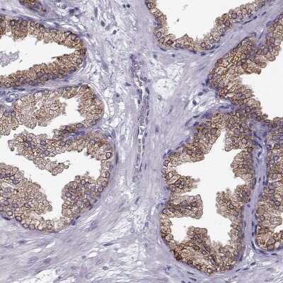 Immunohistochemistry-Paraffin: ELOVL5 Antibody [NBP2-33500] - Staining of human prostate shows moderate granular cytoplasmic positivity in glandular cells.