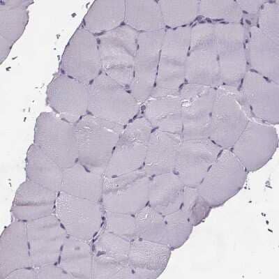 Immunohistochemistry-Paraffin: ELOVL5 Antibody [NBP2-33500] - Staining of human skeletal muscle shows no positivity in myocytes as expected.