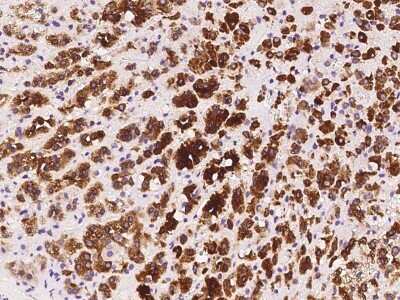 Immunohistochemistry-Paraffin: ELOVL5 Antibody [NBP2-97520] - Immunochemical staining of human ELOVL5 in human adrenal gland with rabbit polyclonal antibody at 1:200 dilution, formalin-fixed paraffin embedded sections.