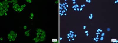 Immunocytochemistry/Immunofluorescence: ELOVL5 Antibody (S07-7B3) [NBP3-19482] - Immunofluorescence of ELOVL5 (green) in Hela cells using NBP3-19482 at dilution 1/200, and DAPI (blue)