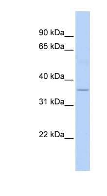 Western Blot: ELOVL5 Antibody [NBP1-59539] - Titration: 0.2-1 ug/ml, Positive Control: Human heart.