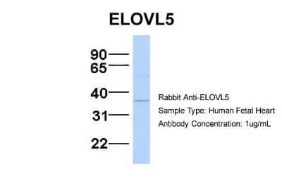 Western Blot: ELOVL5 Antibody [NBP1-59539] - Human Fetal Heart, Antibody Dilution: 1.0 ug/ml.