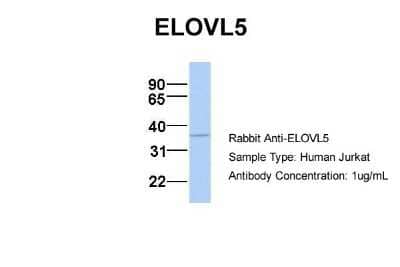 Western Blot: ELOVL5 Antibody [NBP1-59539] - Jurkat, Antibody Dilution: 1.0 ug/ml ELOVL5 is strongly supported by BioGPS gene expression data to be expressed in Human Jurkat cells.