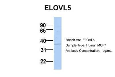 Western Blot: ELOVL5 Antibody [NBP1-59539] - MCF7, Antibody Dilution: 1.0 ug/ml There is BioGPS gene expression data showing that ELOVL5 is expressed in MCF7.