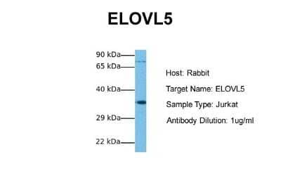 Western Blot: ELOVL5 Antibody [NBP1-59539] - Sample Tissue: Human Jurkat Antibody Dilution: 1.0 ug/ml