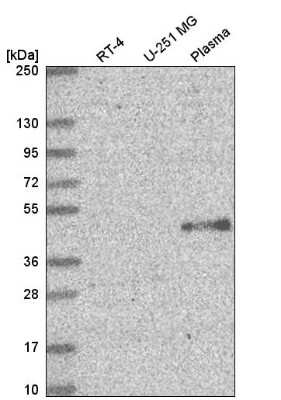 Western Blot: ELOVL5 Antibody [NBP2-58784] - Western blot analysis in human cell line RT-4, human cell line U-251 MG and human plasma.