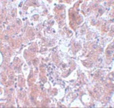 Immunohistochemistry ELOVL7 Antibody - BSA Free