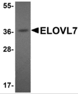 Western Blot ELOVL7 Antibody - BSA Free