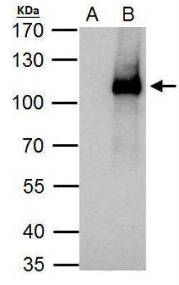 Immunoprecipitation: ELP2 Antibody [NBP2-16321] - HeLa whole cell lysate/extract A. Control with 2 ug of preimmune rabbit IgG B. Immunoprecipitation of ELP2 protein by 2 ug of ELP2 antibody  7.5% SDS-PAGE The immunoprecipitated ELP2 protein was detected by ELP2 antibody diluted at 1:1000. EasyBlot anti-rabbit IgG was used as a secondary reagent.