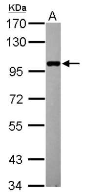 Western Blot: ELP2 Antibody [NBP2-16321] - Sample (20 ug ) A: HeLa nucleus 7. 5% SDS PAGE gel, diluted at 1:1000.