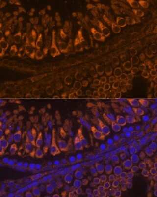 Immunohistochemistry: ELSPBP1 Antibody [NBP3-04400] - Analysis of rat testis using ELSPBP1 antibody at dilution of 1:100. Blue: DAPI for nuclear staining.