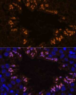 Immunohistochemistry: ELSPBP1 Antibody [NBP3-04400] - Analysis of mouse testis using ELSPBP1 antibody at dilution of 1:100. Blue: DAPI for nuclear staining.