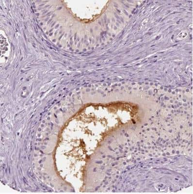 Immunohistochemistry-Paraffin: ELSPBP1 Antibody [NBP2-13958] - Staining of human epididymis shows membranous positivity in glandular cells.