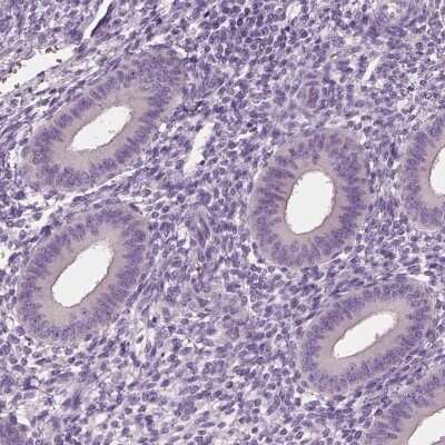 Immunohistochemistry-Paraffin: ELSPBP1 Antibody [NBP2-13958] - Staining of human endometrium shows low expression as expected.