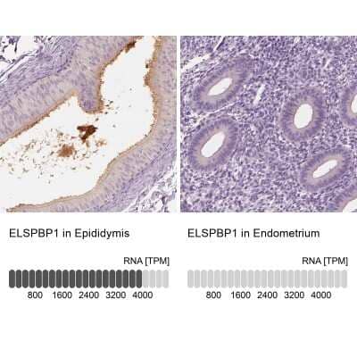 <b>Orthogonal Strategies Validation. </b>Immunohistochemistry-Paraffin: ELSPBP1 Antibody [NBP2-13958] - Staining in human epididymis and endometrium tissues using anti-ELSPBP1 antibody. Corresponding ELSPBP1 RNA-seq data are presented for the same tissues.